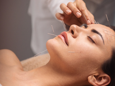 What is acupuncture? 